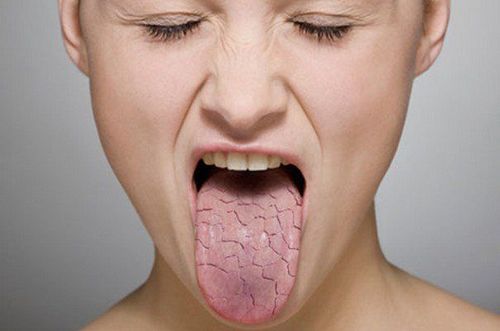 Có nhiều nguyên nhân gây mất vị giác